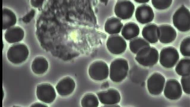 Dirty Acidic Blood Gives Rise to ALL Sickness and Disease