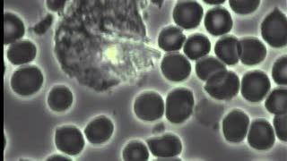 Dirty Acidic Blood Gives Rise to ALL Sickness and Disease