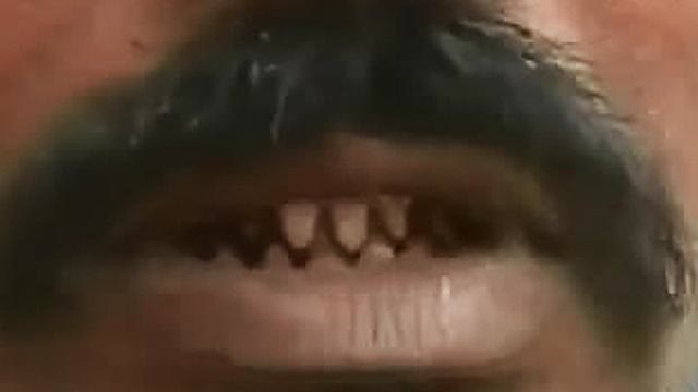 Identifying Reptilian Shapeshifters ((Teeth Morphs)) ((Re-Upload))
