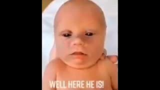 Another black eyed child. Is anyone noticing this? How about nurses in maternity wards? Anyone?