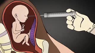 Dr. Anthony Levatino - 3rd Trimester Abortion via LETHAL Injection AUG.22.2018