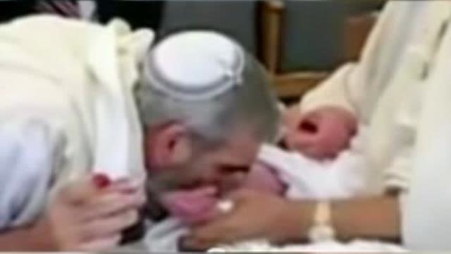 Local Rabbi accused of infecting babies with herpes - Circumcision