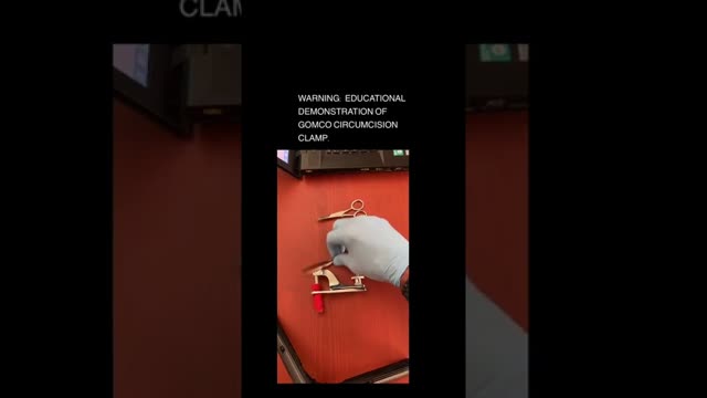 Newborn Circumcision: The Gomco Method