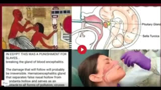 'TEST' SWAB [NANO-BIO-WEAPON?] (ONCE THE LIVING)