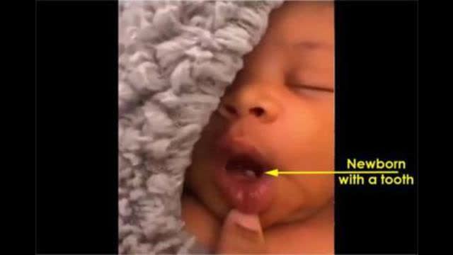 Black eyed babies from the Covid Vaccination era - They are very different.