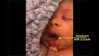 Black eyed babies from the Covid Vaccination era - They are very different.