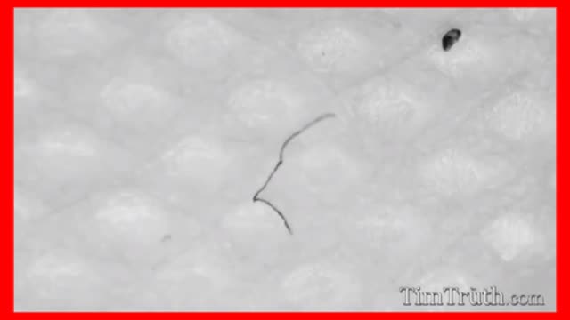 MOVING BLACK STRINGS ON MASKS & SWABS - Best compilation