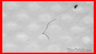 MOVING BLACK STRINGS ON MASKS & SWABS - Best compilation