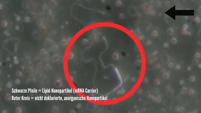 mRNA VAXXINES MICROSCOPED [Pfizer / Moderna]